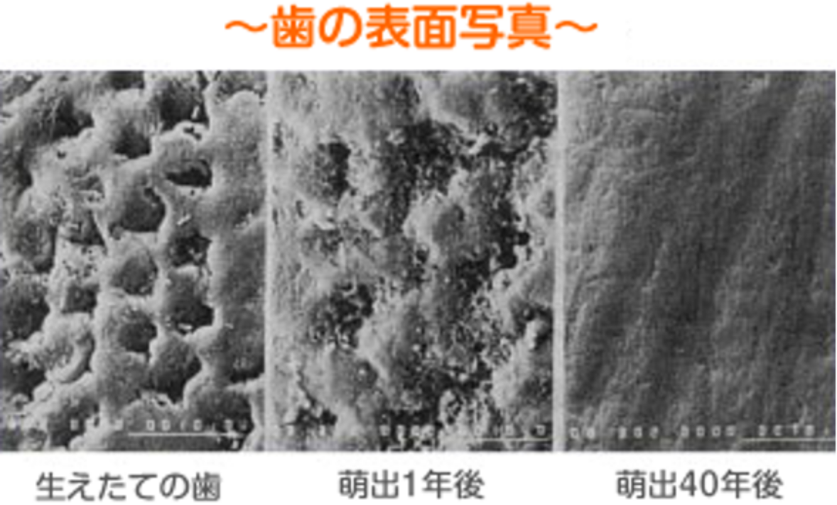 歯の表面の写真
